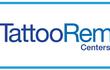 Tattoo Removal Centers Of America